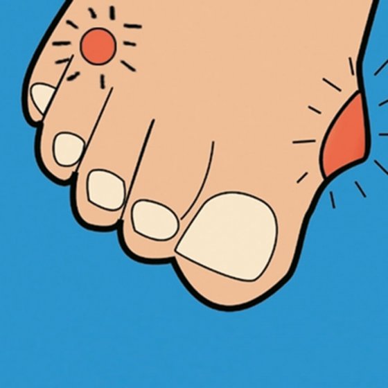 Hühneraugen- und Hornhautstift