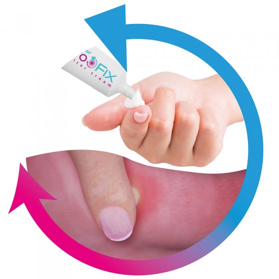 Crème pour les aphtes