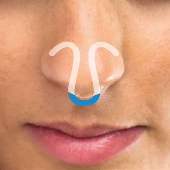 Écarteur nasal Lot de 3  