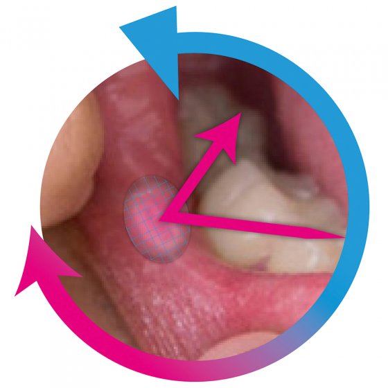 Crème pour les aphtes