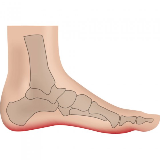 Semelles anti-transpiration Paire 