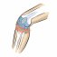 Kniebandage Patellasehne - 5